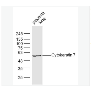 Anti-CK7 antibody-細(xì)胞角蛋白7抗體