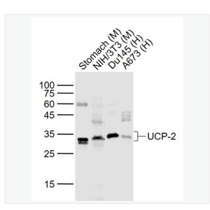 Anti-UCP-2 antibody-线粒体脱偶连蛋白2抗体