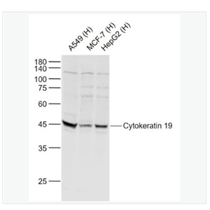 Anti-Cytokeratin 19 antibody-细胞角蛋白19抗体