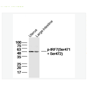Anti-Phospho-IRF7  antibody-磷酸化干扰素调节因子7抗体