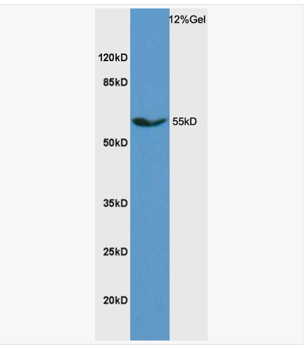 Anti-SCD antibody -固醇酰辅酶A脱氢酶1抗体,SCD