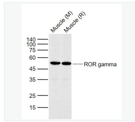 Anti-RORC antibody -孤儿核受体抗体,RORC