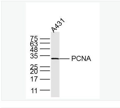 Anti-PCNA -增殖细胞核抗原（核内参）单克隆抗体,PCNA(Nuclear Loading Control)