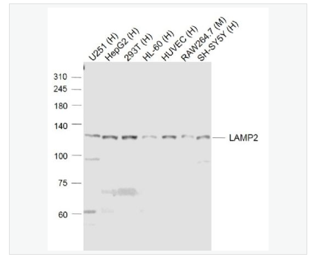 Anti-LAMP2 antibody -溶酶体相关膜蛋白2（CD107B）抗体,LAMP2