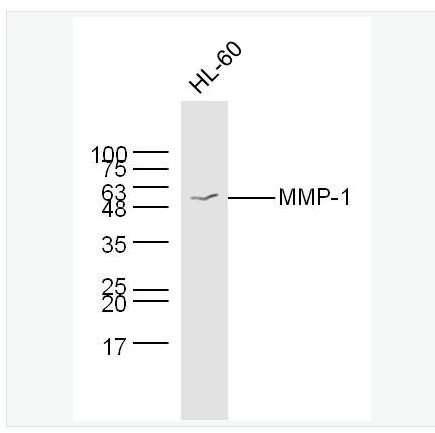 Anti-MMP-1 antibody-基质金属蛋白酶-1抗体,MMP-1