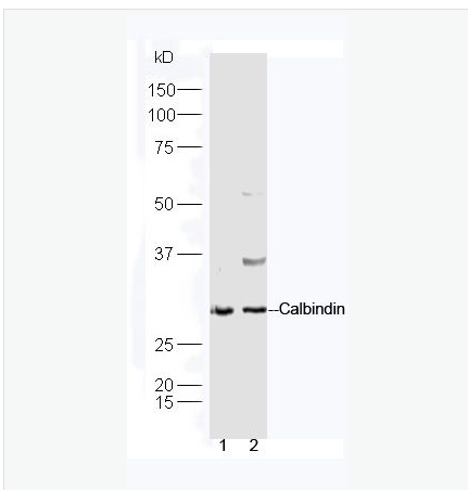 Anti-Calbindin antibody-钙结合蛋白D28K抗体,Calbindin