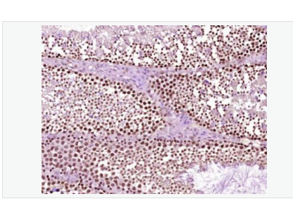 Anti-NFKB p65 antibody-細胞核因子/k基因結(jié)合核因子抗體,NFKB p65