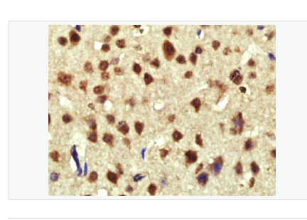 Anti-Cyclin D1 antibody-周期素D1抗体,Cyclin D1