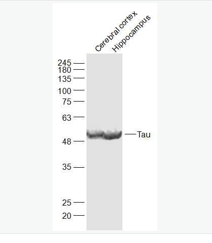 Anti-Tau antibody-微管相关蛋白抗体,Tau