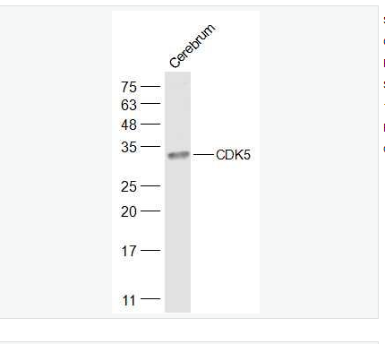 Anti-CDK5 antibody-周期素依赖性激酶5抗体,CDK5