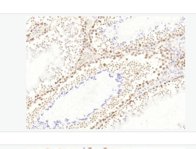 Anti-HP1 gamma antibody-異染色質蛋白1-γ/HP-1γ單克隆抗體,HP1 gamma