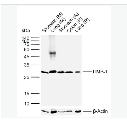 Anti-TIMP-1 antibody-金属蛋白酶组织抑制因子-1单克隆抗体,TIMP-1