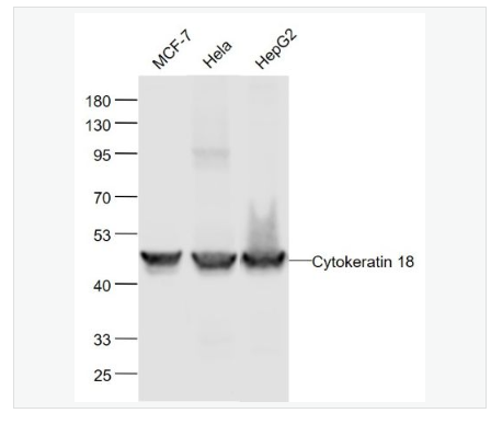 Anti-CK18 antibody-细胞角蛋白18重组兔单克隆抗体,CK18