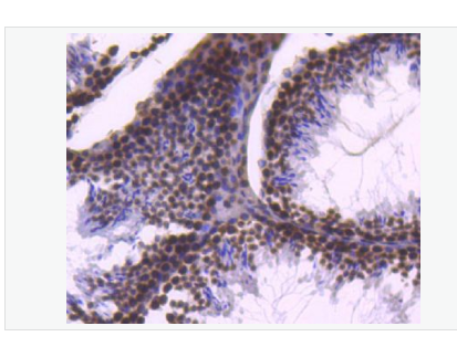 Anti-Histone H2B antibody-组蛋白H2B重组兔单克隆抗体,Histone H2B