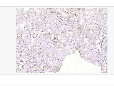 Anti-phospho-ATF2-磷酸化活化复制因子2重组兔单克隆抗体,phospho-ATF2 (Thr71)