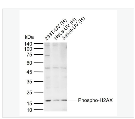 Anti-Phospho-H2AX-磷酸化组蛋白H2AX重组兔单克隆抗体,Phospho-H2AX (Ser139)