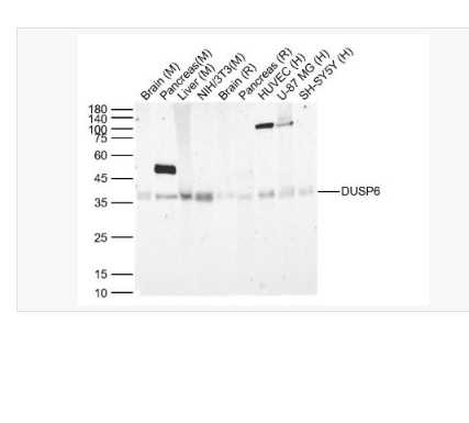 Anti-DUSP6 antibody-双特异性蛋白磷酸酶6重组兔单克隆抗体,DUSP6