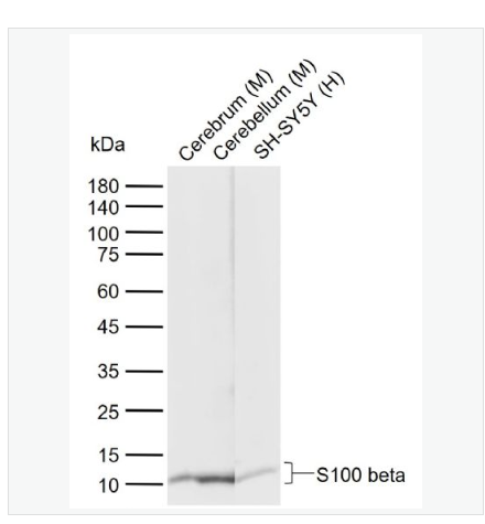Anti-S100 beta antibody-S100B蛋白重组兔单克隆抗体,S100 beta
