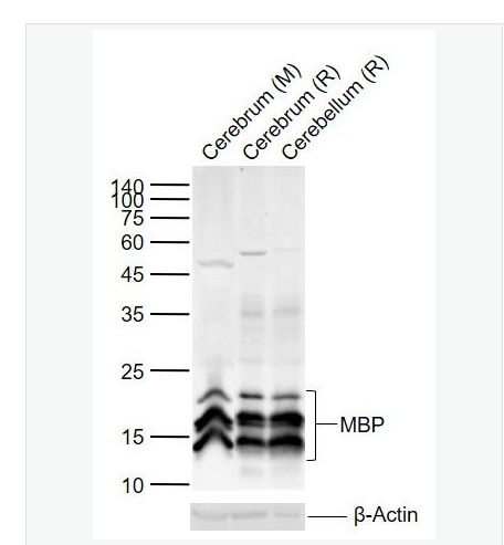 Anti-MBP antibody-髓鞘碱性蛋白/磷脂碱性蛋白抗体,MBP