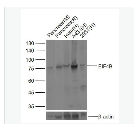 Anti-EIF4B  antibody-真核翻译起始因子4B抗体,EIF4B