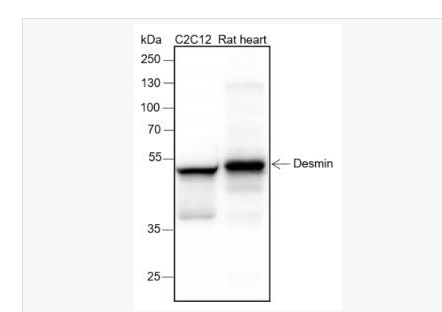 Anti-Desmin antibody-结蛋白重组兔单克隆抗体,Desmin