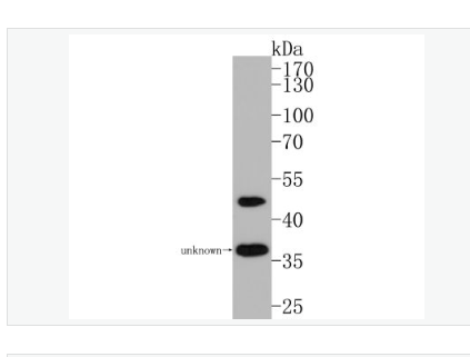 Anti-Nogo-A antibody-轴索过度生长抑制因子-A重组兔单克隆抗体,Nogo-A