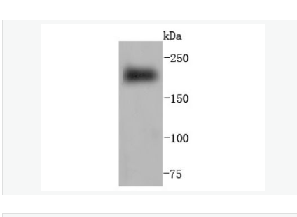 Anti-MYH6 antibody-心肌肌球蛋白重链重组兔单克隆抗体,MYH6