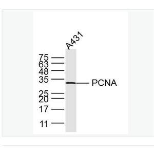 Anti-PCNA -增殖细胞核抗原（核内参）单克隆抗体,PCNA(Nuclear Loading Control)