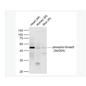 Anti-phospho-Smad3 antibody-磷酸化细胞信号转导分子SMAD3抗体
