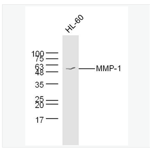 Anti-MMP-1 antibody-基质金属蛋白酶-1抗体