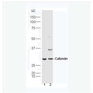 Anti-Calbindin antibody-钙结合蛋白D28K抗体