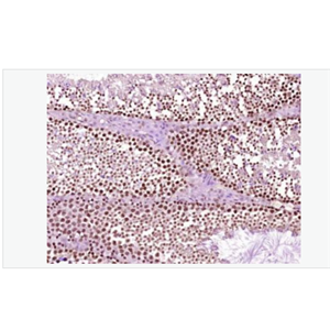 Anti-phospho-Src (Ser75) antibody-磷酸化src原癌基因抗体,phospho-Src (Ser75)