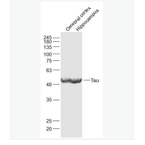 Anti-Tau antibody-微管相关蛋白抗体