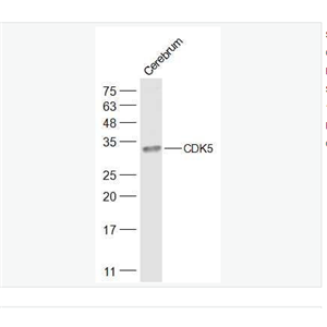 Anti-CDK5 antibody-周期素依赖性激酶5抗体