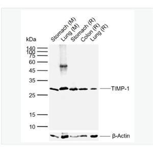 Anti-TIMP-1 antibody-金属蛋白酶组织抑制因子-1单克隆抗体