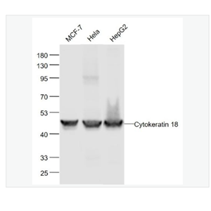 Anti-CK18 antibody-细胞角蛋白18重组兔单克隆抗体,CK18