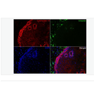 Anti-Cytokeratin 16 antibody-细胞角蛋白16重组兔单克隆抗体,Cytokeratin 16