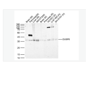 Anti-DUSP6 antibody-双特异性蛋白磷酸酶6重组兔单克隆抗体