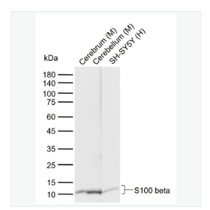 Anti-S100 beta antibody-S100B蛋白重组兔单克隆抗体