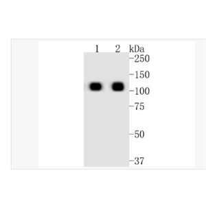 Anti-ACE2 antibody-重组兔血管紧张素转换酶单克隆抗体