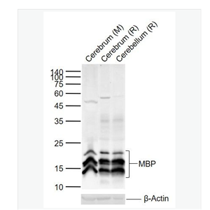 Anti-MBP antibody-髓鞘碱性蛋白/磷脂碱性蛋白抗体