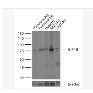 Anti-EIF4B  antibody-真核翻译起始因子4B抗体