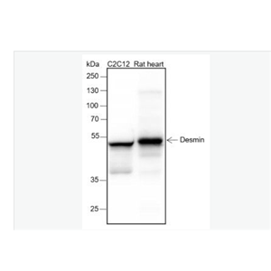 Anti-Desmin antibody-结蛋白重组兔单克隆抗体