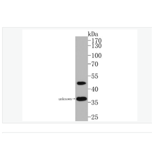 Anti-Nogo-A antibody-轴索过度生长抑制因子-A重组兔单克隆抗体