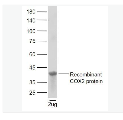 Anti-Cyclooxygenase 2 antibody-環(huán)氧合酶2抗體,Cyclooxygenase 2