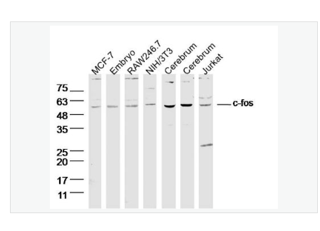 Anti-c-fos antibody-c-fos抗体,c-fos