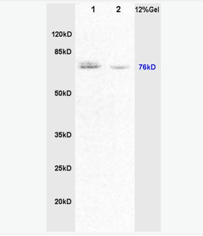 Anti-CRF antibody-蓬乱蛋白1抗体,DVL1