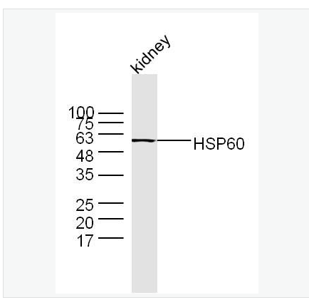 Anti-HSP60 antibody-热休克蛋白-60/groEL抗体,HSP60