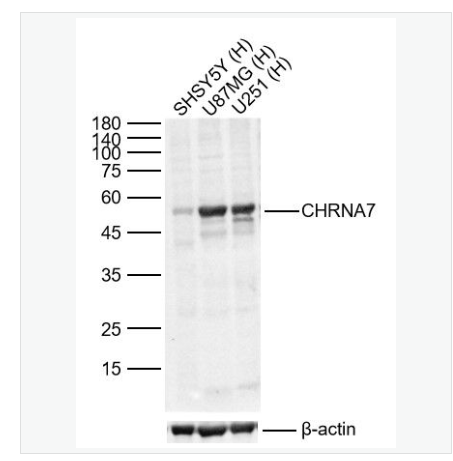 Anti-CHRNA7 antibody-烟碱型乙酰胆碱受体α7抗体,CHRNA7