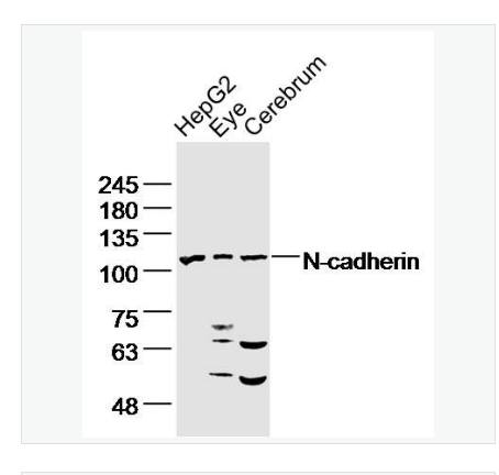 Anti-N-cadherin antibody-N-钙粘附分子抗体,N-cadherin